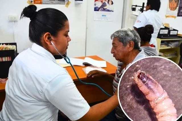 En 2 semanas se duplican casos de gusano barrenador en humanos en Puebla